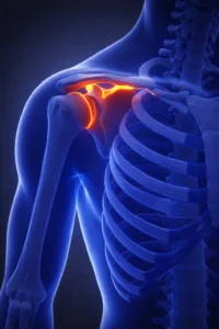 shoulder treatment dubai