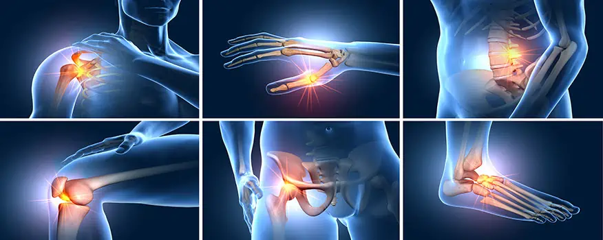 Orthopedic joint pain and hip shoulder illustration