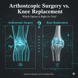 Arthroscopic Surgery vs. Knee Replacement: Which Option is Right for You?