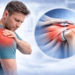 Top Orthopedic Shoulder Doctor in Dubai | Dr Usama Saleh