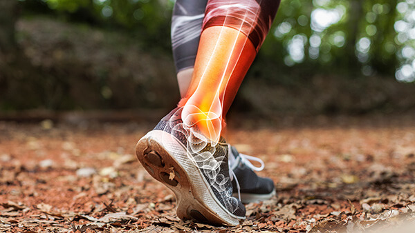 Conservative Treatment for Sports Injuries