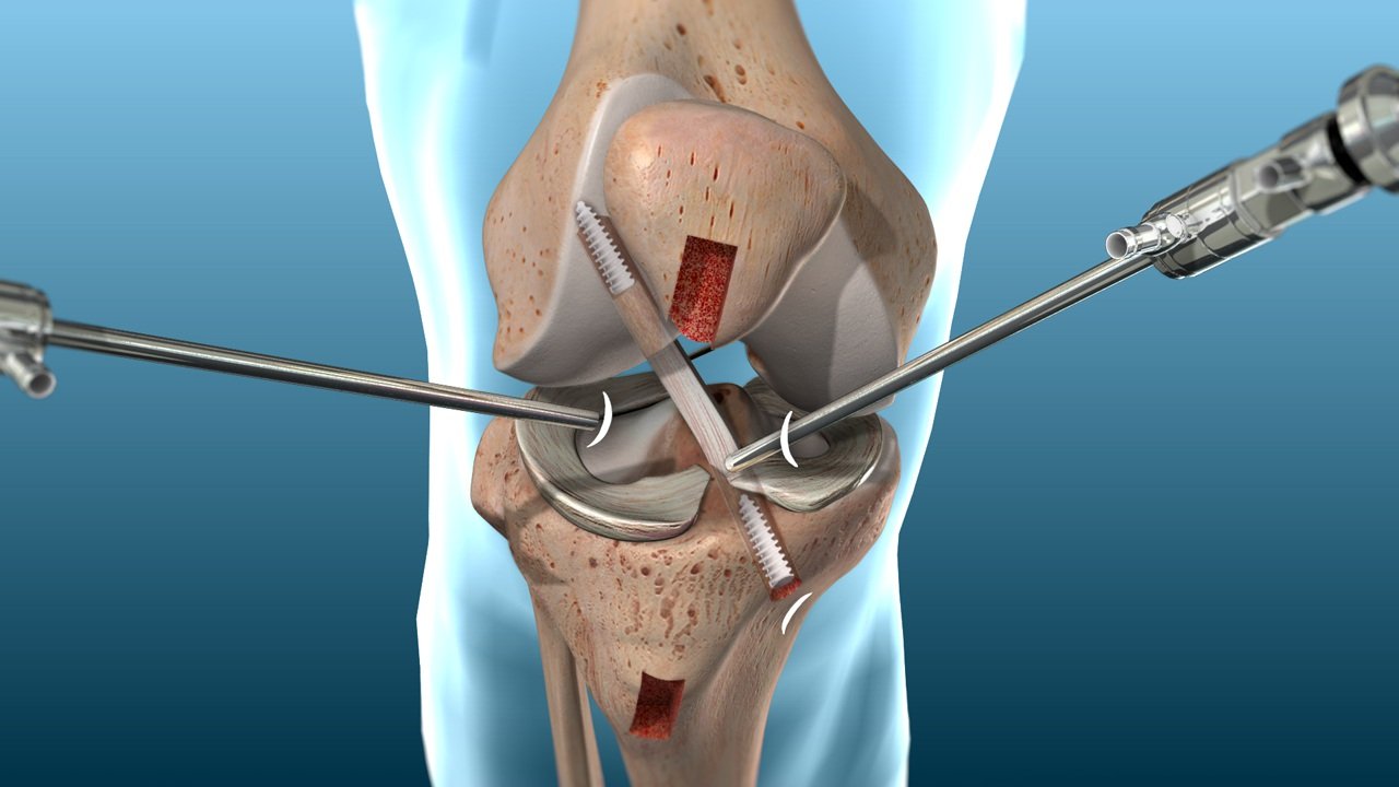Knee joint rehabilitation training