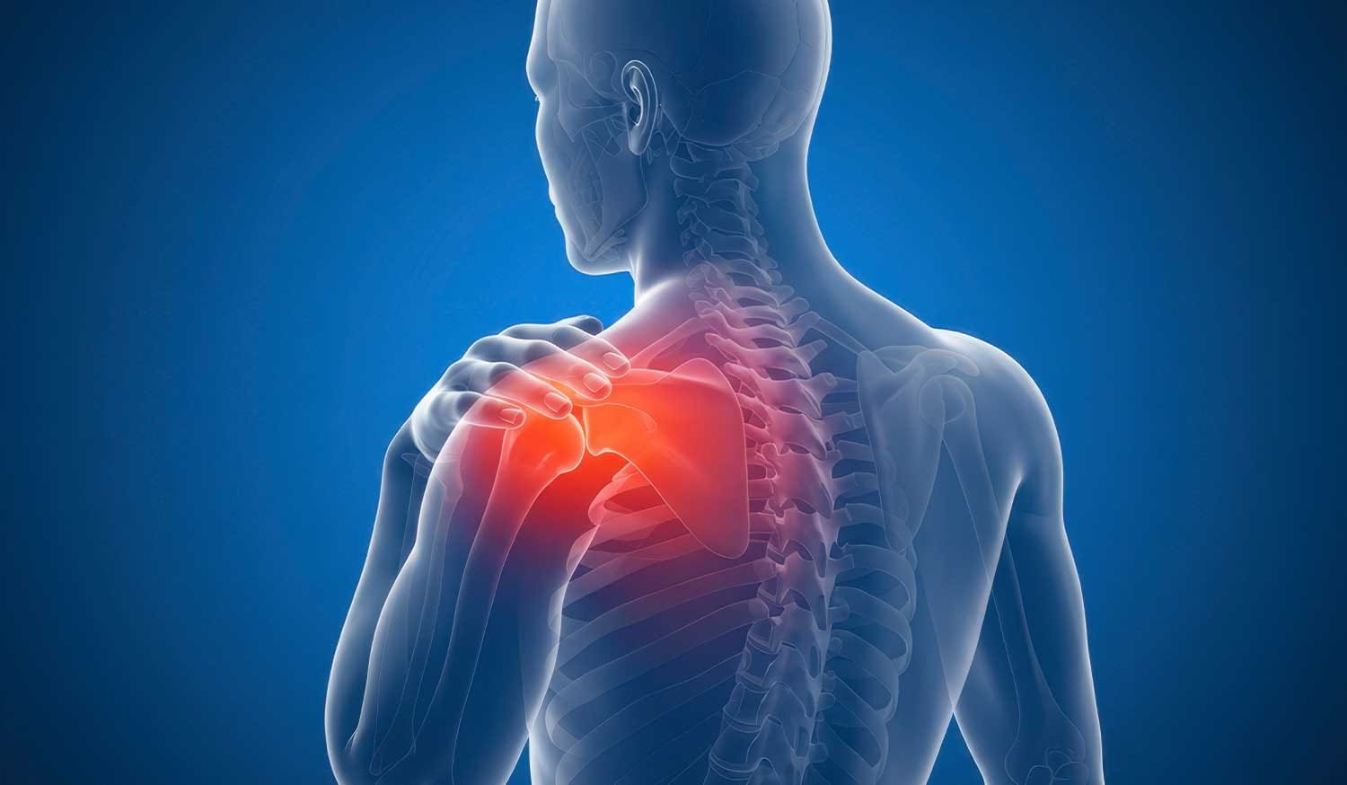 Shoulder labral tear and shoulder joint pain illustration