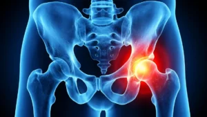 hip joint pain causes