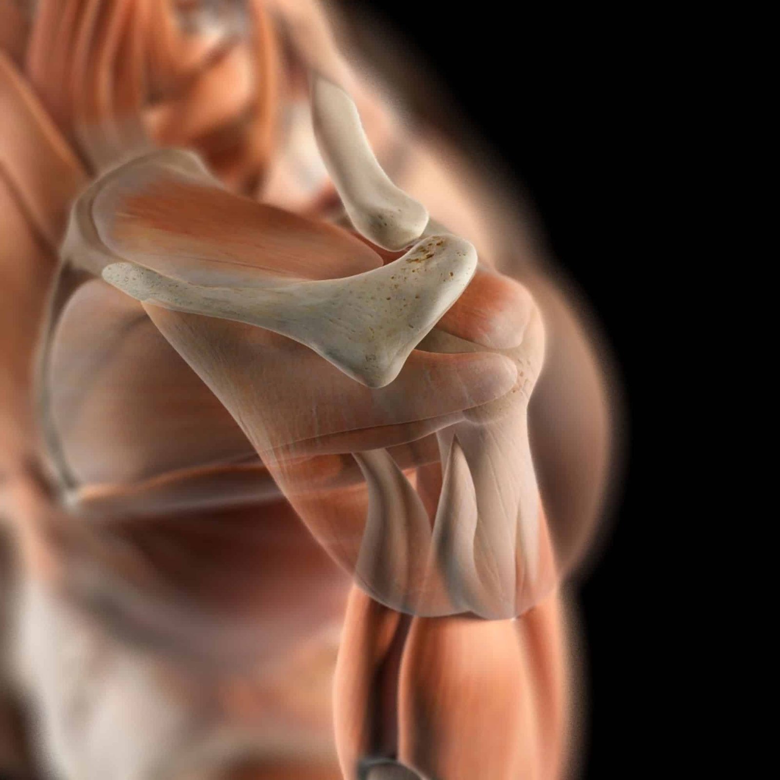 Rotator Cuff Repair 2