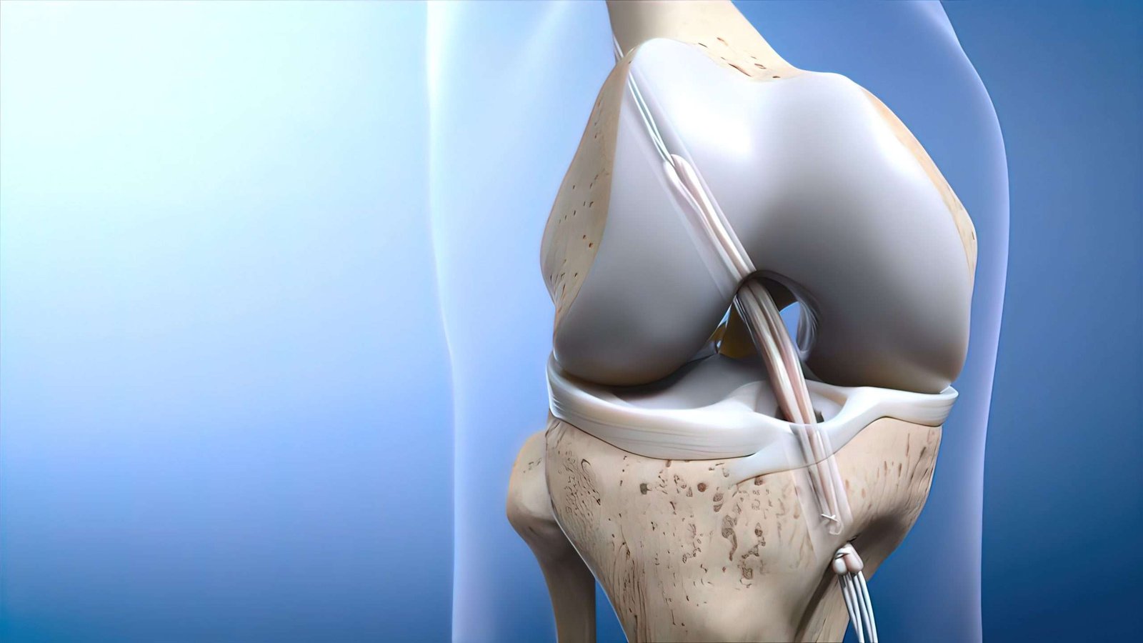 MCL tear symptoms