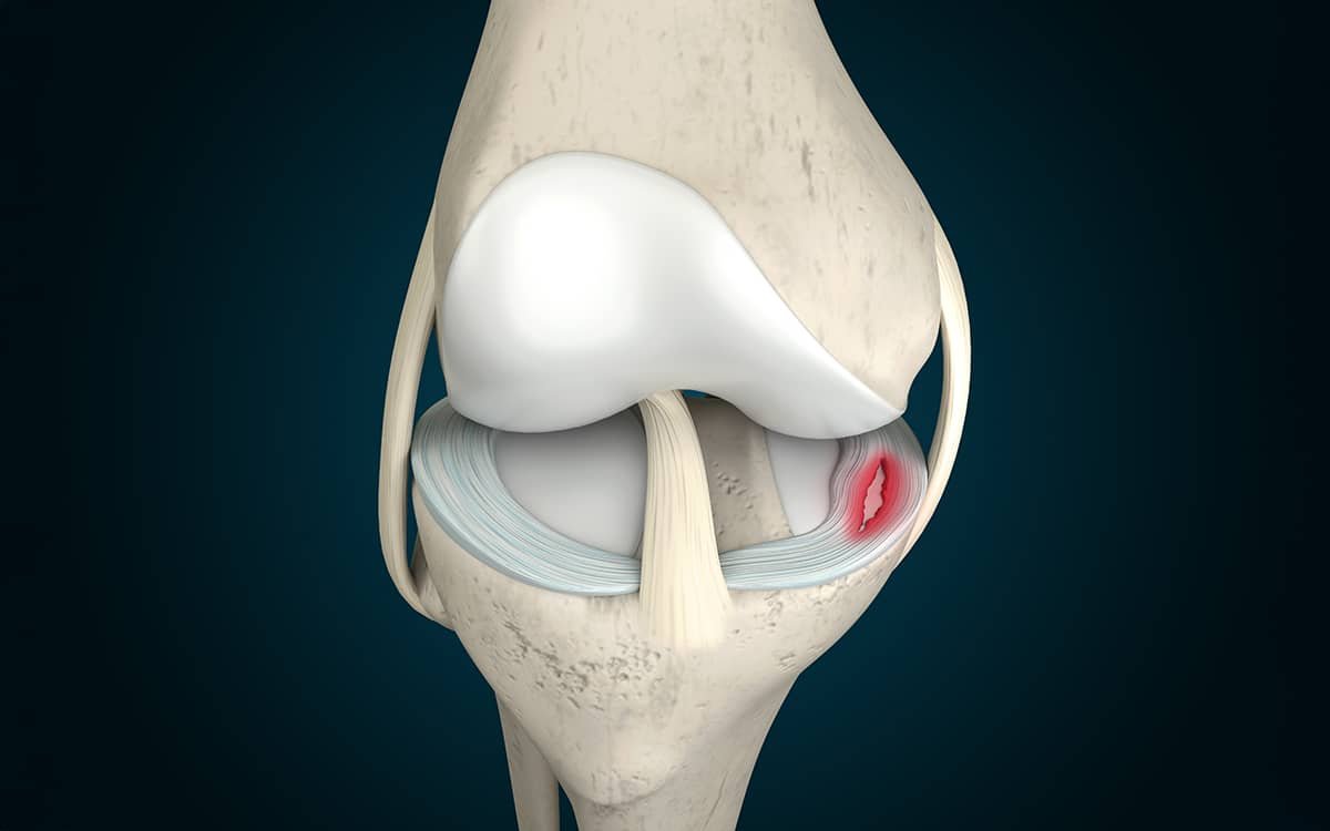 Urgent Knee Assessment Profile 1