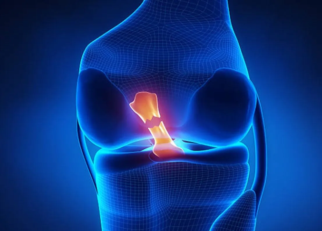 Total & Partial Knee Replacement