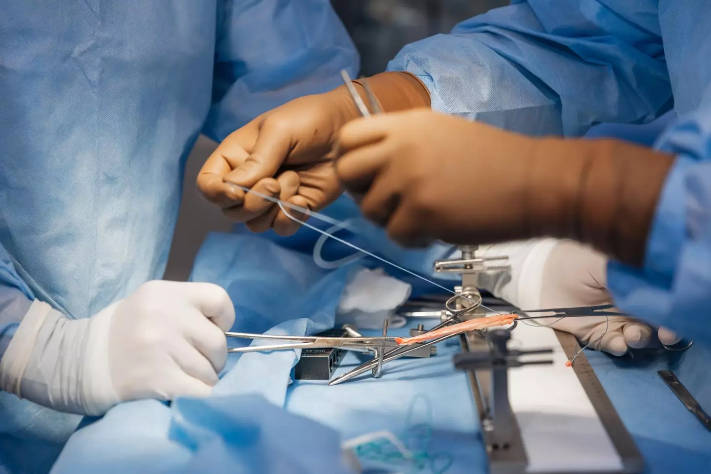 Upper Extremity Surgery