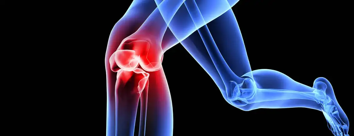 knie head