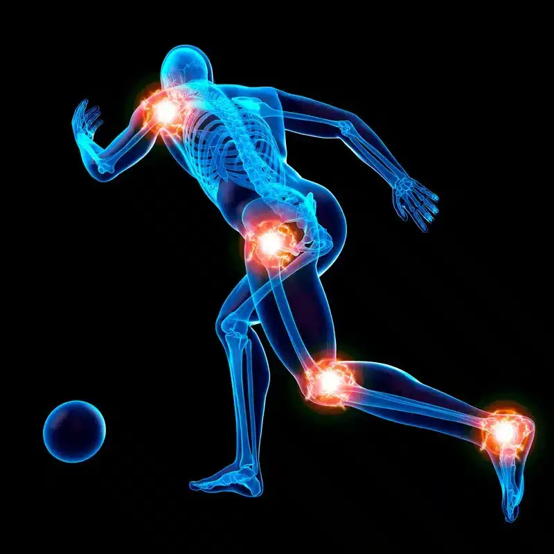 Patellar Tendonitis