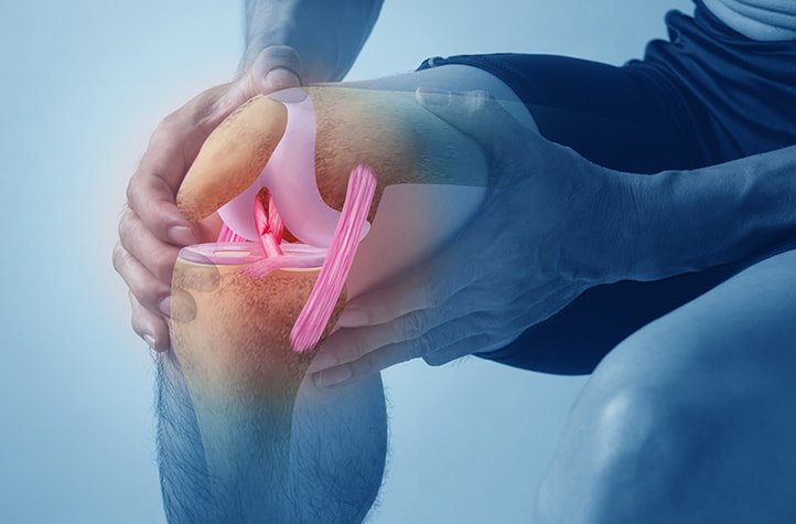 Stage 4 severe knee osteoarthritis treatment
