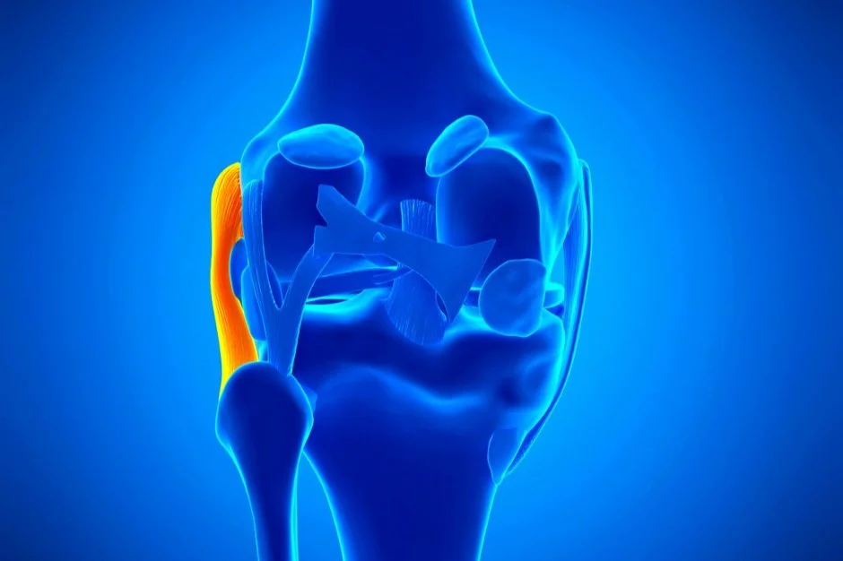 LCL Tear (Lateral Collateral Ligament) trauma scan