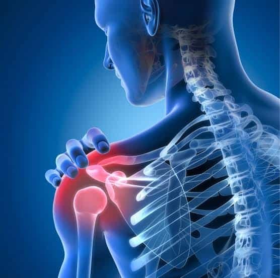 Rotator Cuff Tears Arthroscopy