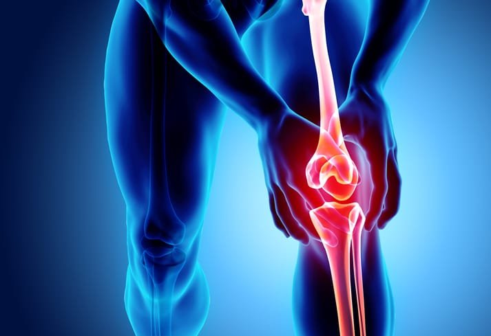Knee model used for injection planning