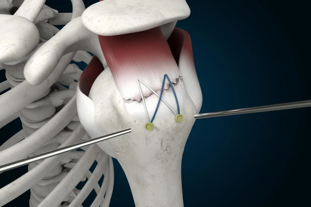 Hamstring tendon graft preparation